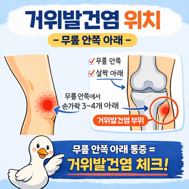 런닌이 무릎부상 거위발건염, 제2회 영광 광풍 마라톤 남편 따라 다녀왔어요.(참가x)