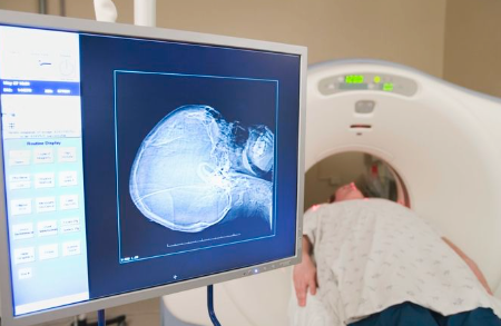 뇌 MRI MRA CT 차이점 뜻부터 비용 검사방법까지 알아보자 : 네이버 블로그