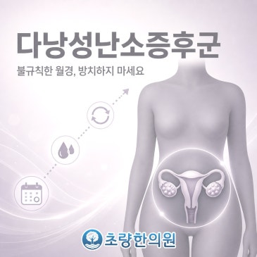 다낭성난소증후군 내게 맞는 대처법 찾아보자 부산동구 초량 초량한의원