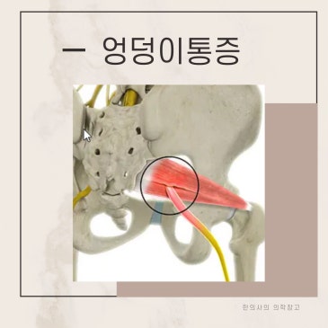 일산 엉덩이통증, 초음파 근막치료에서 관찰되는 반응