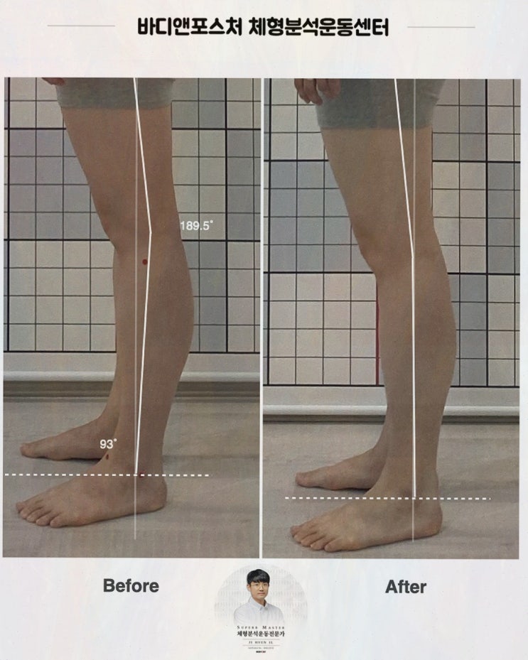 바디앤포스처 체형교정 센터 창곡동 필라테스, 13년차 물리치료사가 원인부터 봐주는 곳