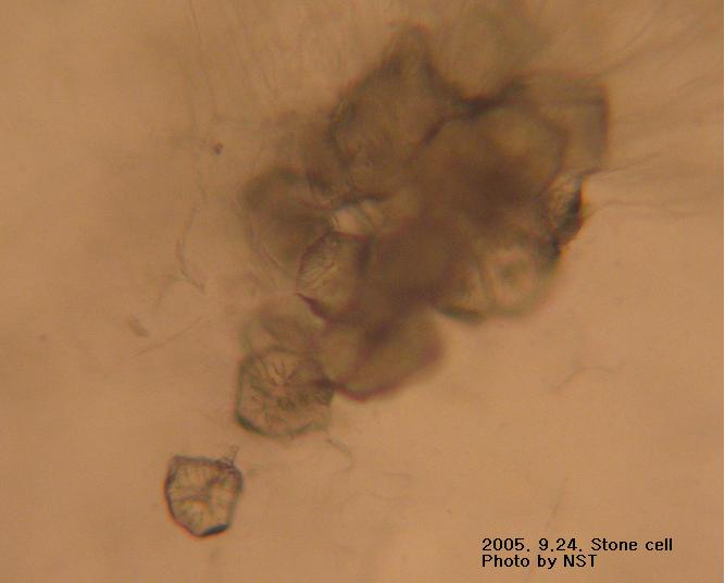 석세포(Stone cell) : 네이버 블로그