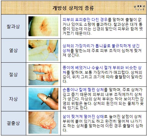 개방성 상처의 종류 : 네이버 블로그