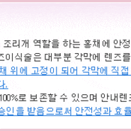 ★알티 플렉스 렌즈☞알티플렉스 라식 안내삽입렌즈의 부작용에 관한 모 안과에서의 질문과 답변....강남역라식